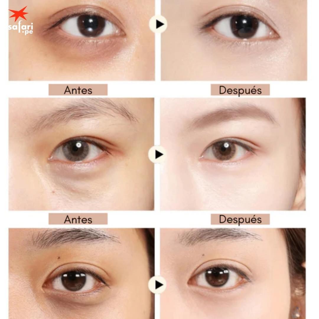 EYEPADS: Parches para ojeras y lineas de expresión