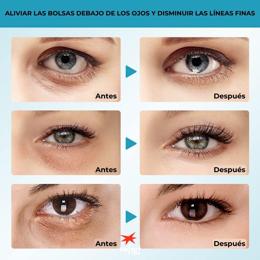EYEPADS: Parches para ojeras y lineas de expresión
