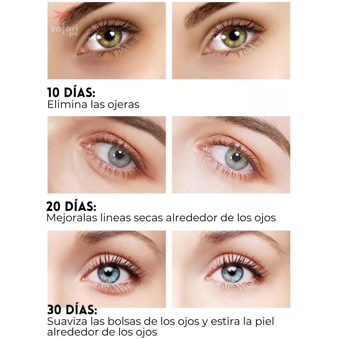 EYEPADS:  Parches para ojeras y lineas de expresión