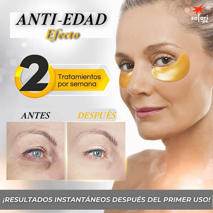 EYEPADS:  Parches para ojeras y lineas de expresión